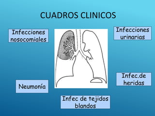 CUADROS CLINICOS
Infecciones
urinarias
Infec.de
heridas
Neumonía
Infecciones
nosocomiales
Infec de tejidos
blandos
 