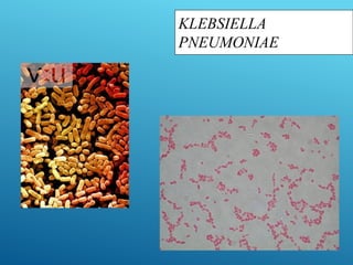 KLEBSIELLA
PNEUMONIAE
 