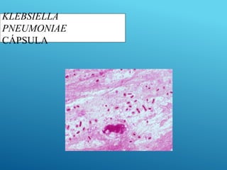 KLEBSIELLA
PNEUMONIAE
CÁPSULA
 