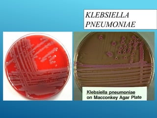 KLEBSIELLA
PNEUMONIAE
 