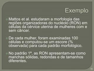 ExemploMattos et al. estudaram a morfologia das regiões organizadoras do nucléolo (RON) em células da cérvice uterina de mulheres com e sem câncer.De cada mulher, foram examinadas 100 células e computou-se um escore (% observada) para cada padrão morfológico.No padrão 1ª, as RON apresentam-se como manchas sólidas, redondas e de tamanhos diferentes.10
