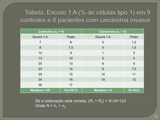 Tabela. Escore 1 A (% de células tipo 1) em 9 controles e 8 pacientes com carcinoma invasorSe a ordenação está correta, (R1 + R2) = N (N+1)/2Onde N = n1 + n212