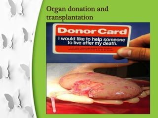 Organ donation and
transplantation
 