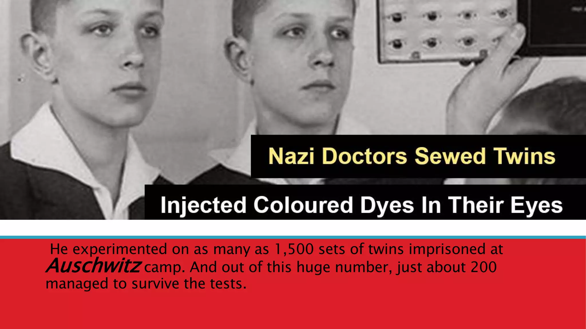 He experimented on as many as 1,500 sets of twins imprisoned at
Auschwitz camp. And out of this huge number, just about 200
managed to survive the tests.
 