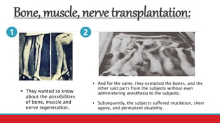 Bone, muscle, nervetransplantation:
 They wanted to know
about the possibilities
of bone, muscle and
nerve regeneration.
 And for the same, they extracted the bones, and the
other said parts from the subjects without even
administering anesthesia to the subjects.
 Subsequently, the subjects suffered mutilation, sheer
agony, and permanent disability.
1 2
 