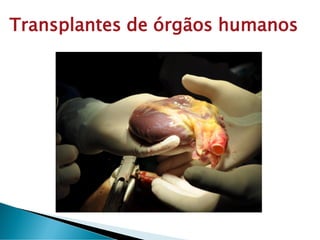 Transplantes de órgãos humanos
 