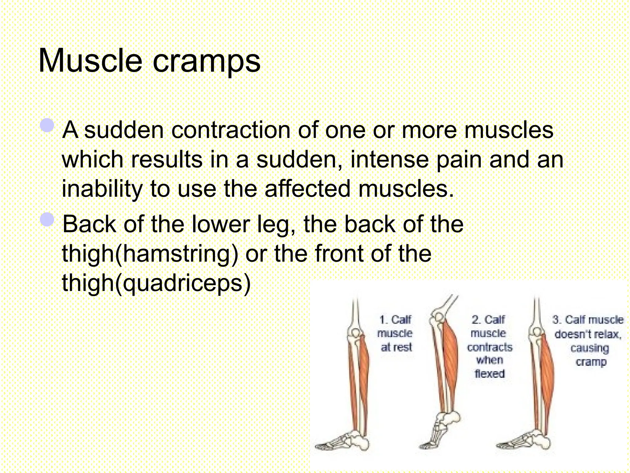 Muscle cramps
A sudden contraction of one or more muscles
which results in a sudden, intense pain and an
inability to use the affected muscles.
Back of the lower leg, the back of the
thigh(hamstring) or the front of the
thigh(quadriceps)
 