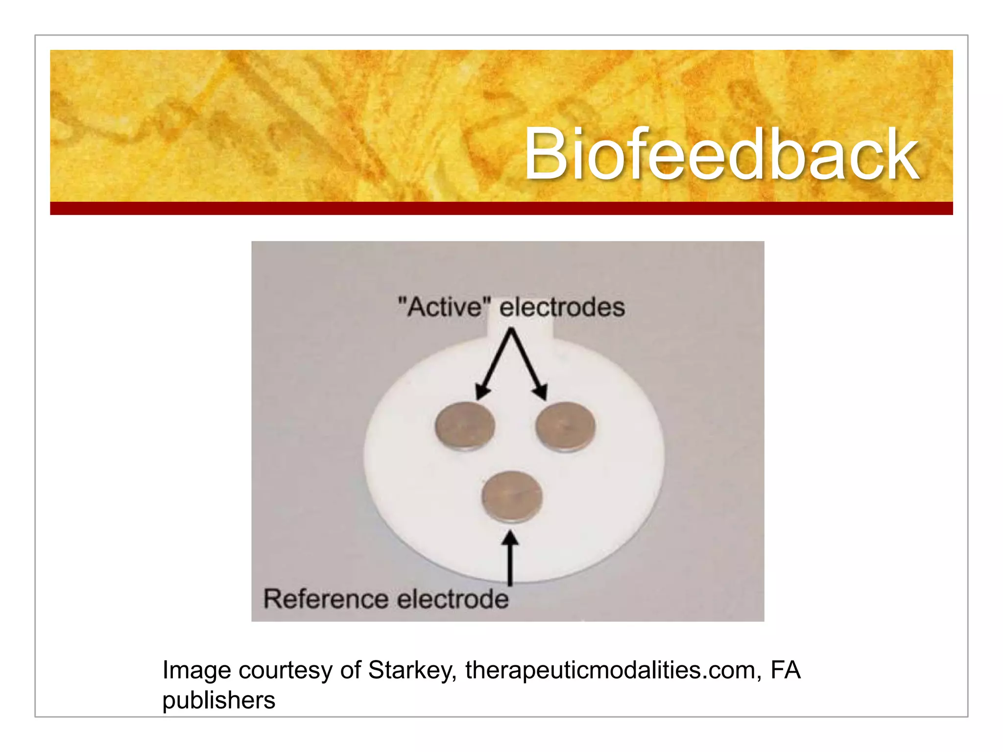BiofeedbackImage courtesy of Starkey, therapeuticmodalities.com, FA publishers