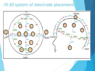 10-20 system of electrode placement:
 