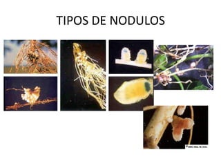 TIPOS DE NODULOS 
 