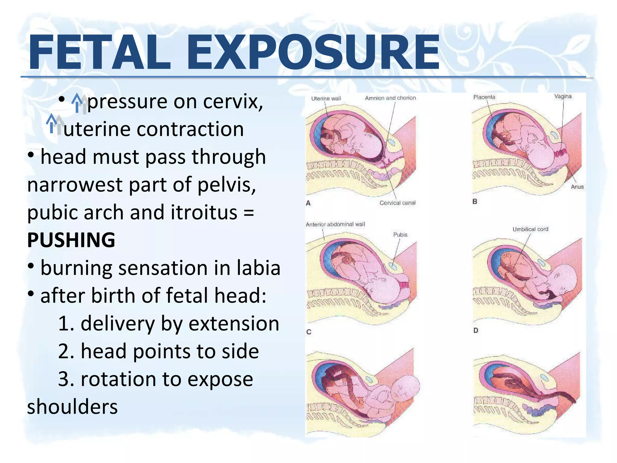 FETAL EXPOSURE pressure on cervix,  uterine contraction head must pass through narrowest part of pelvis, pubic arch and itroitus =  PUSHING burning sensation in labia after birth of fetal head: 1. delivery by extension 2. head points to side 3. rotation to expose  shoulders 