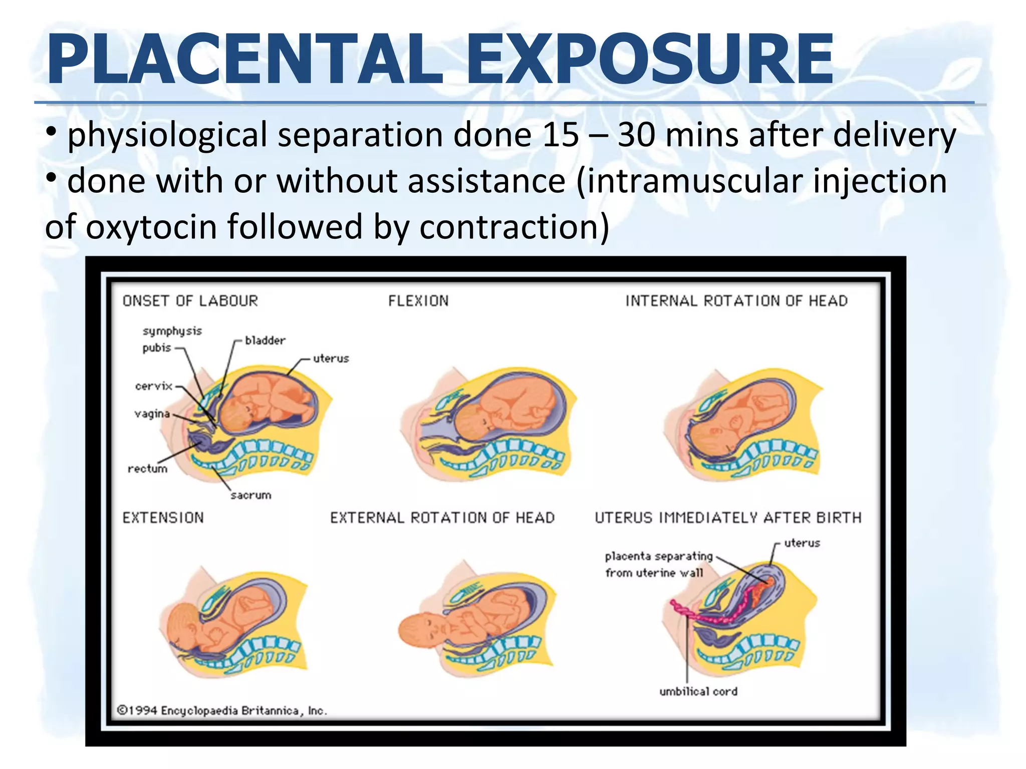 PLACENTAL EXPOSURE physiological separation done 15 – 30 mins after delivery  done with or without assistance (intramuscular injection of oxytocin followed by contraction) 