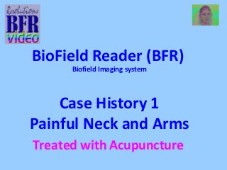 BioField Reader (BFR) 
Biofield Imaging system 
Case History 1 
Painful Neck and Arms 
Treated with Acupuncture 
 