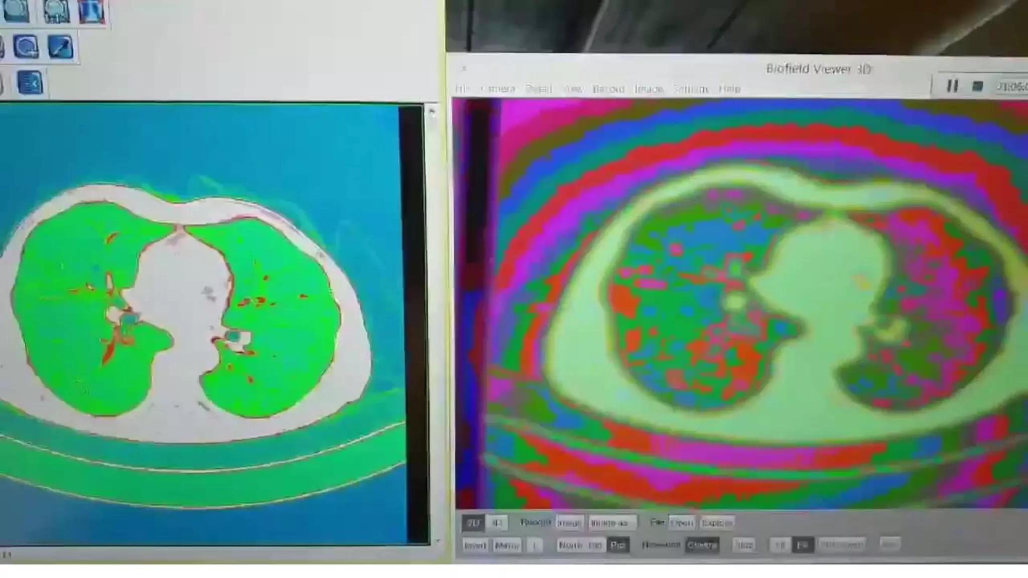 Biofield Sci Lab enhancing PET Scan
 