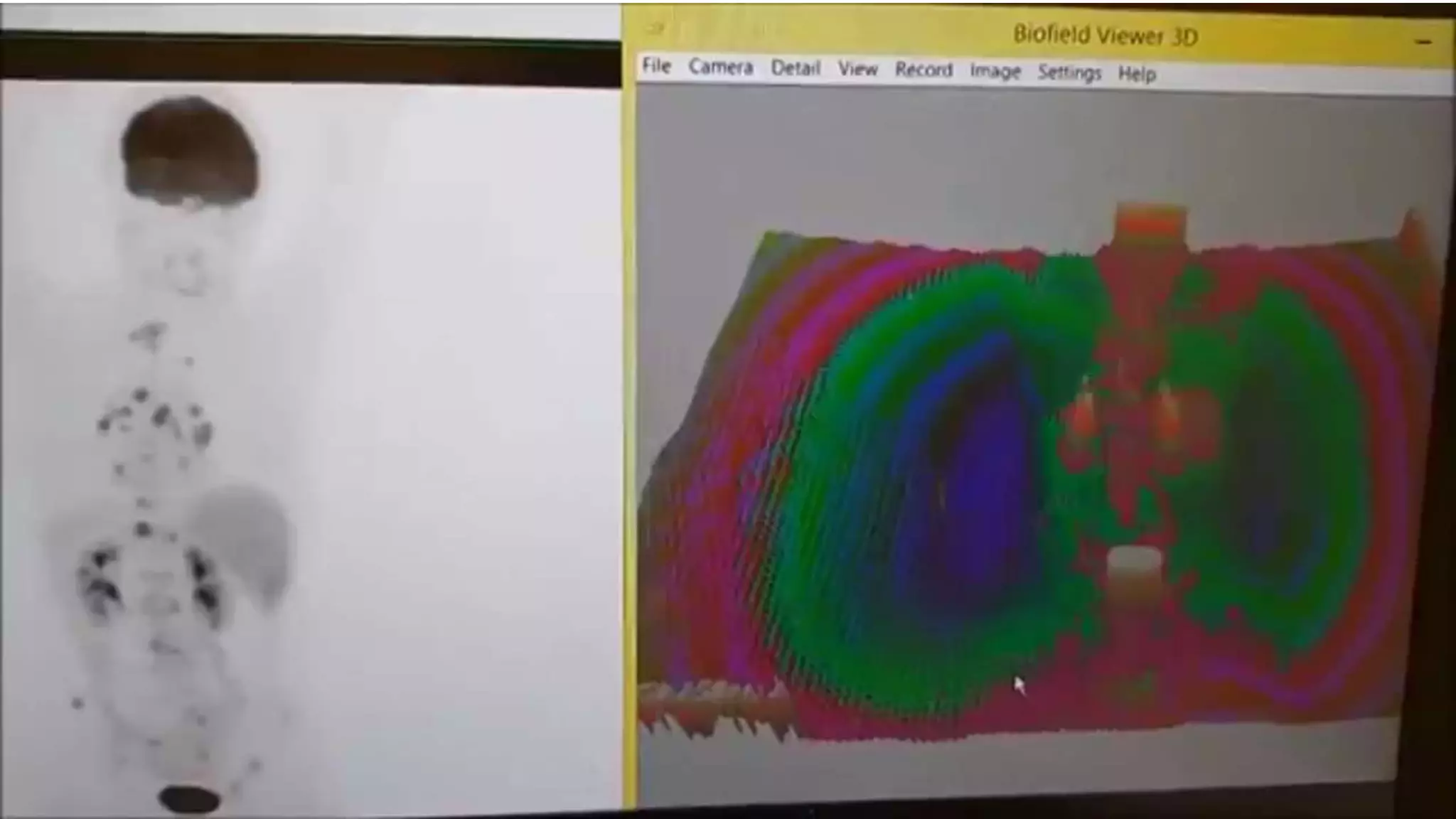 Biofield Sci Lab
enhancing PET
Scan
 