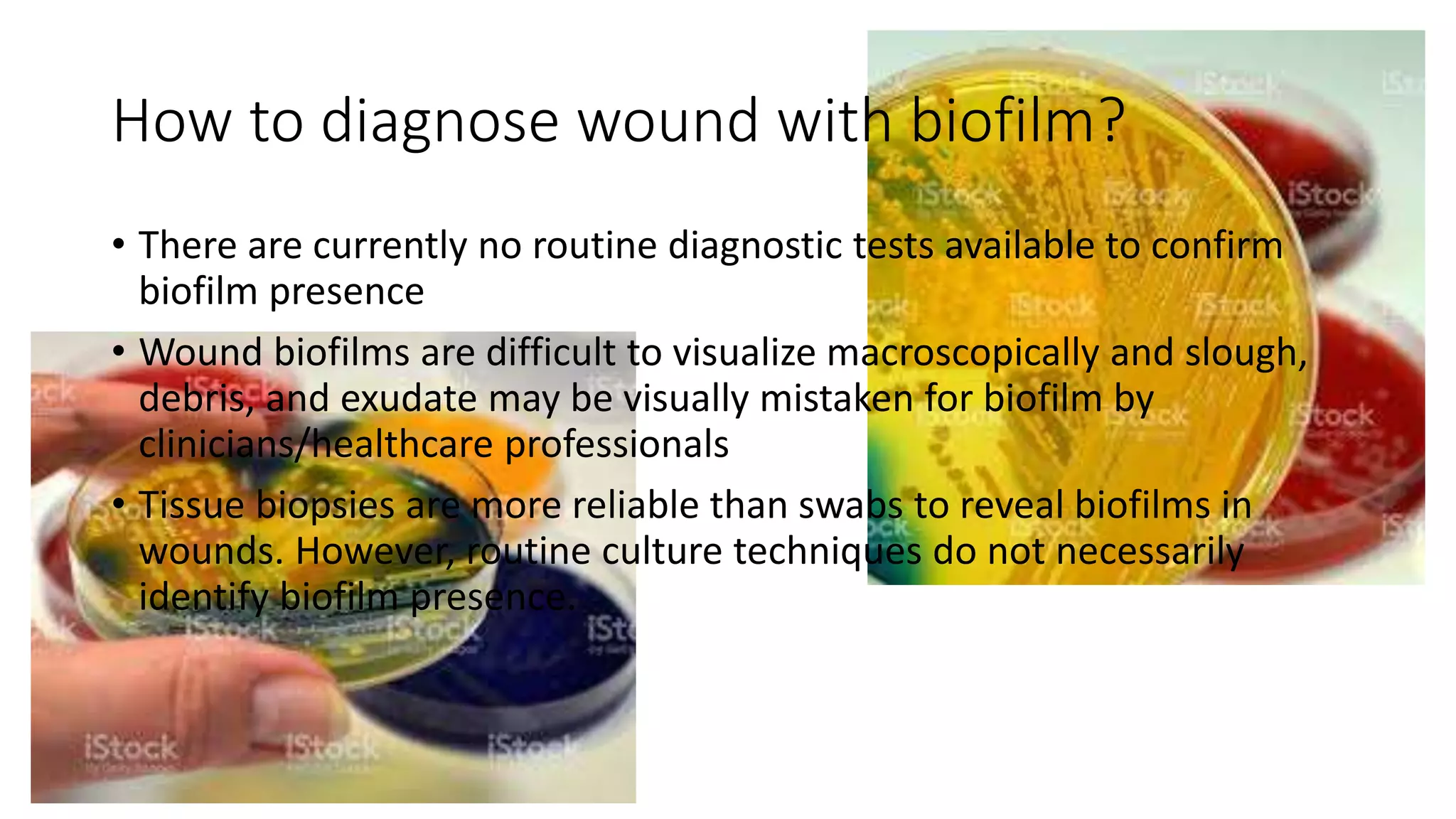 Biofilm | PPTX
