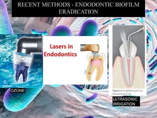 OZONE
ULTRASONIC
IRRIGATION
 