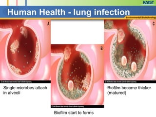 Human Health - lung infectionEnvironmental Biotechnology
Single microbes attach
in alveoli
Biofilm start to forms
Biofilm become thicker
(matured)
 