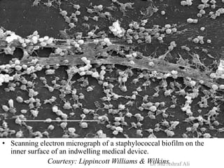 • Scanning electron micrograph of a staphylococcal biofilm on the
inner surface of an indwelling medical device.
Courtesy: Lippincott Williams & Wilkins.Dr Md Ashraf Ali
 