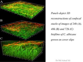 Panels depict 3D
reconstructions of confocal
stacks of images of 24h (A),
48h (B) and 72h (C)
biofilms of C. albicans
grown on cover slips
Dr Md Ashraf Ali
 