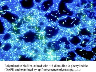 Polymicrobic biofilm stained with 4,6-diamidino-2-phenylindole
(DAPI) and examined by epifluorescence microscopyDr Md Ashraf Ali
 