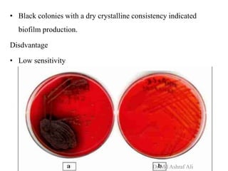• Black colonies with a dry crystalline consistency indicated
biofilm production.
Disdvantage
• Low sensitivity
Dr Md Ashraf Ali
 