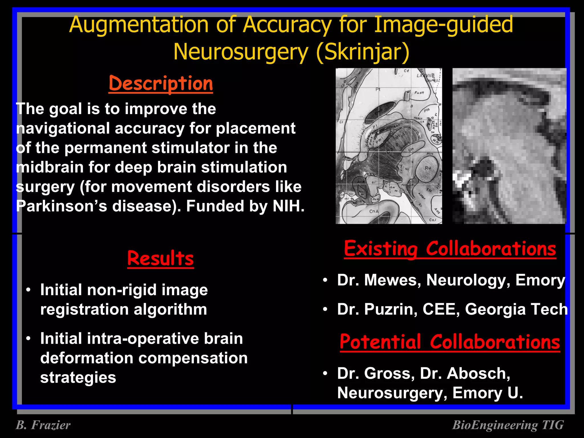 Augmentation of Accuracy for Image-guided
                 Neurosurgery (Skrinjar)
             Description
The goal is to improve the
navigational accuracy for placement
of the permanent stimulator in the
midbrain for deep brain stimulation
surgery (for movement disorders like
Parkinson’s disease). Funded by NIH.

                                         Existing Collaborations
               Results
                                       • Dr. Mewes, Neurology, Emory
 • Initial non-rigid image
   registration algorithm              • Dr. Puzrin, CEE, Georgia Tech
 • Initial intra-operative brain         Potential Collaborations
   deformation compensation
   strategies                          • Dr. Gross, Dr. Abosch,
                                         Neurosurgery, Emory U.
B. Frazier                                             BioEngineering TIG
 