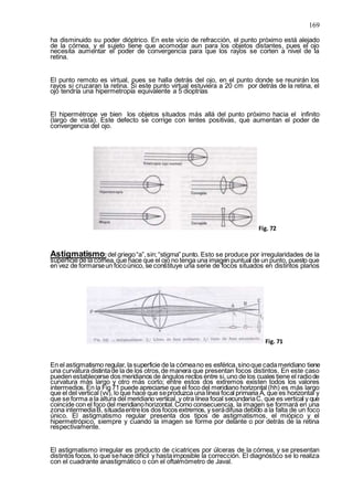 169
ha disminuido su poder dióptrico. En este vicio de refracción, el punto próximo está alejado
de la córnea, y el sujeto tiene que acomodar aun para los objetos distantes, pues el ojo
necesita aumentar el poder de convergencia para que los rayos se corten a nivel de la
retina.
El punto remoto es virtual, pues se halla detrás del ojo, en el punto donde se reunirán los
rayos si cruzaran la retina. Si este punto virtual estuviera a 20 cm por detrás de la retina, el
ojo tendría una hipermetropía equivalente a 5 dioptrías
El hipermétrope ve bien los objetos situados más allá del punto próximo hacia el infinito
(largo de vista). Este defecto se corrige con lentes positivas, que aumentan el poder de
convergencia del ojo.
Fig. 72
Astigmatismo:del griego“a”,sin;“stigma” punto. Esto se produce por irregularidades de la
superficie de la córnea, que hace que el ojo no tenga una imagen puntual de un punto, puesto que
en vez de formarseun focoúnico, se constituye una serie de focos situados en distintos planos
Fig. 71
En el astigmatismo regular, la superficie de la córneano es esférica,sinoque cadameridiano tiene
una curvatura distintade la de los otros,de manera que presentan focos distintos. En este caso
pueden establecerse dos meridianos de ángulos rectos entre si,uno de los cuales tiene el radiode
curvatura más largo y otro más corto; entre estos dos extremos existen todos los valores
intermedios. En la Fig 71 puede apreciarse que el foco del meridiano horizontal (hh) es más largo
que el del vertical (vv), lo que hace que seproduzca una línea focal primaria A, que es horizontal y
que se forma a la altura del meridiano vertical, y otra línea focal secundariaC, que es vertical y que
coincide con el foco del meridianohorizontal.Como consecuencia, la imagen se formará en una
zona intermediaB, situadaentrelos dos focos extremos, y serádifusa debido a la falta de un foco
único. El astigmatismo regular presenta dos tipos de astigmatismos, el miópico y el
hipermetrópico, siempre y cuando la imagen se forme por delante o por detrás de la retina
respectivamente.
El astigmatismo irregular es producto de cicatrices por úlceras de la córnea, y se presentan
distintos focos, lo que sehace difícil y hastaimposible la corrección. El diagnóstico se lo realiza
con el cuadrante anastigmático o con el oftalmómetro de Javal.
 