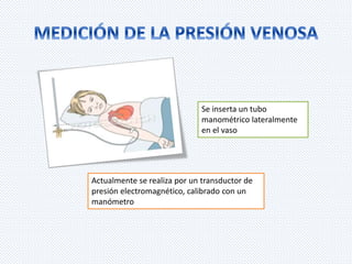 Se inserta un tubo 
manométrico lateralmente 
en el vaso 
Actualmente se realiza por un transductor de 
presión electromagnético, calibrado con un 
manómetro 
 