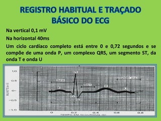 Na vertical 0,1 mV 
Na horizontal 40ms 
Um ciclo cardíaco completo está entre 0 e 0,72 segundos e se 
compõe de uma onda P, um complexo QRS, um segmento ST, da 
onda T e onda U 
 
