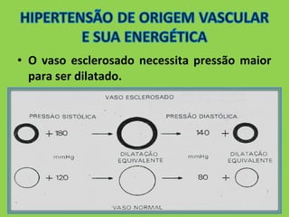 • O vaso esclerosado necessita pressão maior 
para ser dilatado. 
 