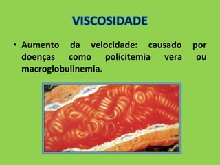 • Aumento da velocidade: causado por 
doenças como policitemia vera ou 
macroglobulinemia. 
 