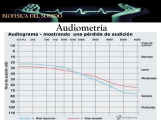 BIOFISICA DEL SONIDO

Audiometría
• Para la vía ósea se pone en contacto con la apófisis
mastoides un vibrador conveniente.

• Estos datos se grafican en coordenadas cartesianas.
• Existe una gráfica normal del sujeto tipo y sobre estos
parámetros se puede determinar la normalidad de
audiograma.

 