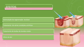 EFEITOS
Estimulação da regeneração tecidual
Tratamento de várias condições artríticas
Tratamento de lesões de tecidos moles
Alívio da dor
 