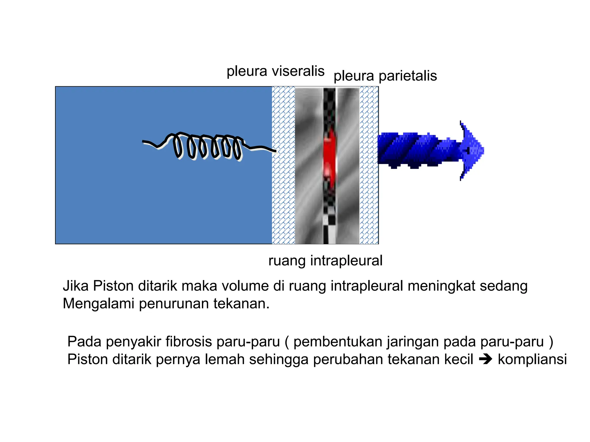 pleura viseralis pleura parietalis
ruang intrapleural
Jika Piston ditarik maka volume di ruang intrapleural meningkat sedang
Mengalami penurunan tekanan.
Pada penyakir fibrosis paru-paru ( pembentukan jaringan pada paru-paru )
Piston ditarik pernya lemah sehingga perubahan tekanan kecil  kompliansi
 