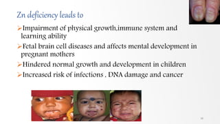 Zn deficiency leads to
Impairment of physical growth,immune system and
learning ability
Fetal brain cell diseases and affects mental development in
pregnant mothers
Hindered normal growth and development in children
Increased risk of infections , DNA damage and cancer
38
 