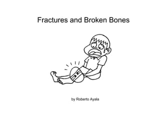 Fractures and Broken Bones by Roberto Ayala 