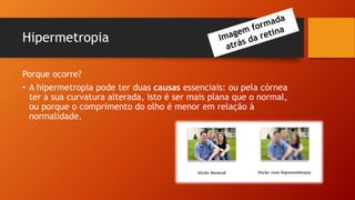 Hipermetropia
Porque ocorre?
• A hipermetropia pode ter duas causas essenciais: ou pela córnea
ter a sua curvatura alterada, isto é ser mais plana que o normal,
ou porque o comprimento do olho é menor em relação à
normalidade.
 