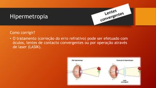 Hipermetropia
Como corrigir?
• O tratamento (correção do erro refrativo) pode ser efetuado com
óculos, lentes de contacto convergentes ou por operação através
de laser (LASIK).
 