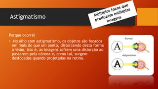 Astigmatismo
Porque ocorre?
• No olho com astigmatismo, os objetos são focados
em mais do que um ponto, distorcendo desta forma
a visão, isto é, as imagens sofrem uma distorção ao
passarem pela córnea e, como tal, surgem
desfocadas quando projetadas na retina.
 