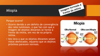 Miopia
Porque ocorre?
• Ocorre devido a um defeito de convergência
dos raios luminosos, o que faz com que a
imagem de objetos distantes se forme à
frente da retina, em vez de na própria
retina.
• Isto leva a que os objetos distantes sejam
vistos desfocados, equanto que os objetos
próximos parecem normais.
 
