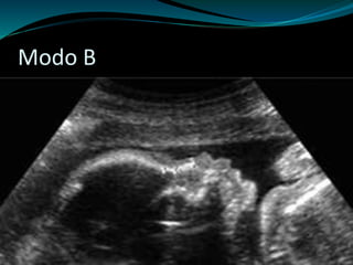 Modo B 
 