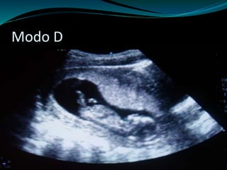 Modo D 
 