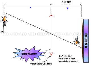 CRISTALINO
RETINA
1,5 mm
p p’
i- A imagem
retiniana é real,
invertida e menor.
Músculos Ciliares
O
 