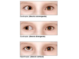 Biofísica da visão