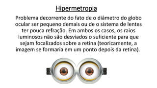 Hipermetropia
Problema decorrente do fato de o diâmetro do globo
ocular ser pequeno demais ou de o sistema de lentes
ter pouca refração. Em ambos os casos, os raios
luminosos não são desviados o suficiente para que
sejam focalizados sobre a retina (teoricamente, a
imagem se formaria em um ponto depois da retina).
 