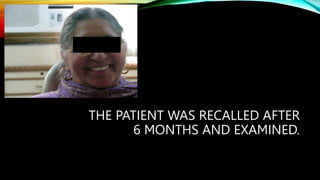 THE PATIENT WAS RECALLED AFTER
6 MONTHS AND EXAMINED.
 