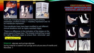 FIRST CLINICAL VISIT
PRIMARY IMPRESSION AND
TENTATIVE JAW RELATION
There are 15 trays provided for recording the primary
impression, of which 5 trays --- maxillary impression and 10
for mandibular impression .
The mandibular trays have been modified to suit different
clinical situations such as highly resorbed ridges.
There is a difference in the inclination of the slopes on the
distal aspect of these trays. The sharply inclined tray is used
for highly resorbed ridges to ensure that-- retromolar pad
-- impression.
“tray selection tool”
Material- alginate and syringe alginate
Syring material is loaded into syringe and sulcuse area of maxilla and
Mandible 7
 