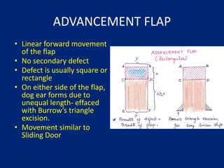Comprehensive Biogeometry and Techniques of Local Flaps in Plastic ...