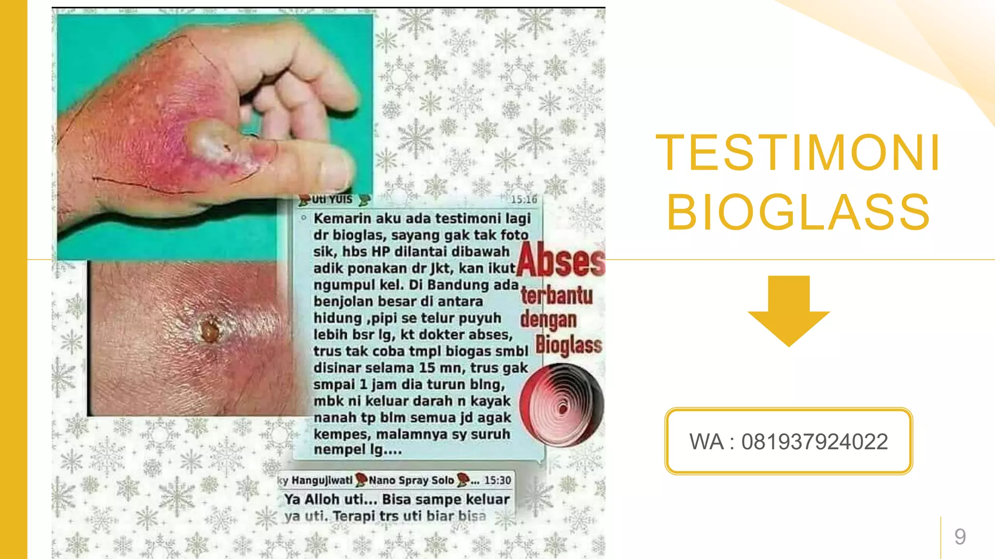 Bioglass untuk abses | PPTX